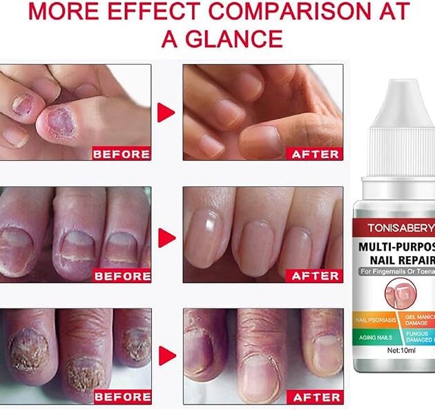جل تصليح الأظافر