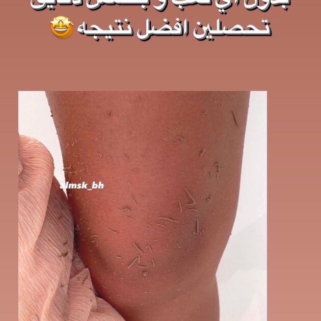ليفة تقشير جسم الكورية لتقشير الجسم وازالة الجلد الميت
